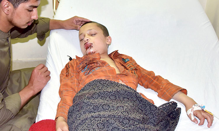 Injured-Kashmiri