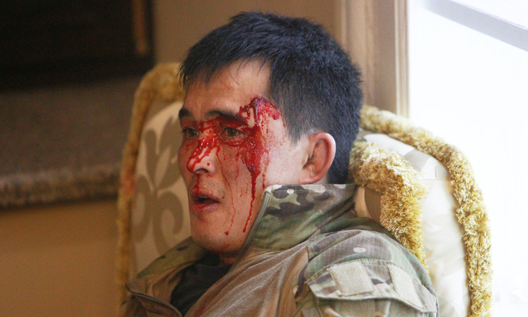 Kyrgyzstan_Injured-member-750