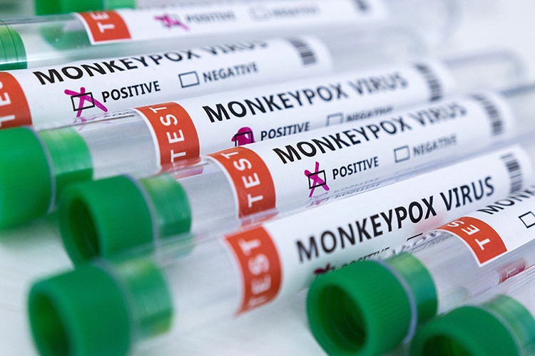 monkeypox-tube