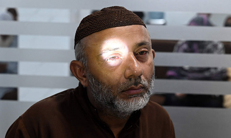 Eye-patient-Pakistan
