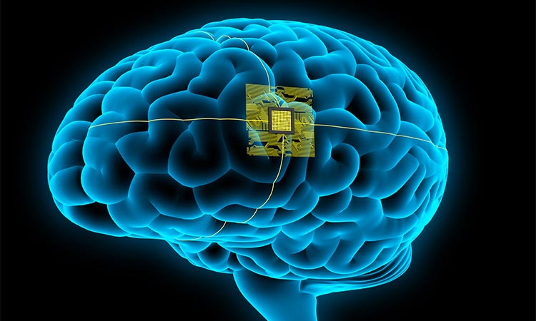 With a chip in your head, will you be guided by your brain, or by your chip?