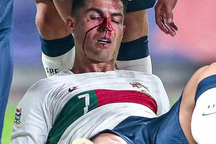 Ronaldo-Injury