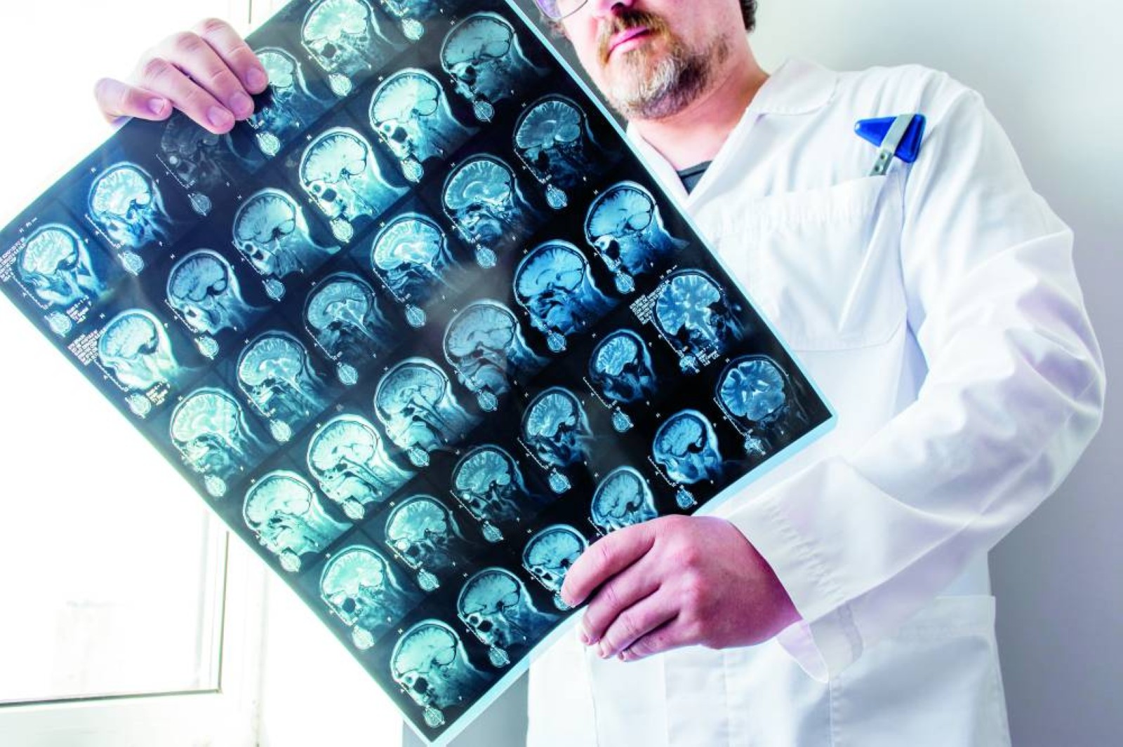 Brain surgery saves life of boy with rare condition