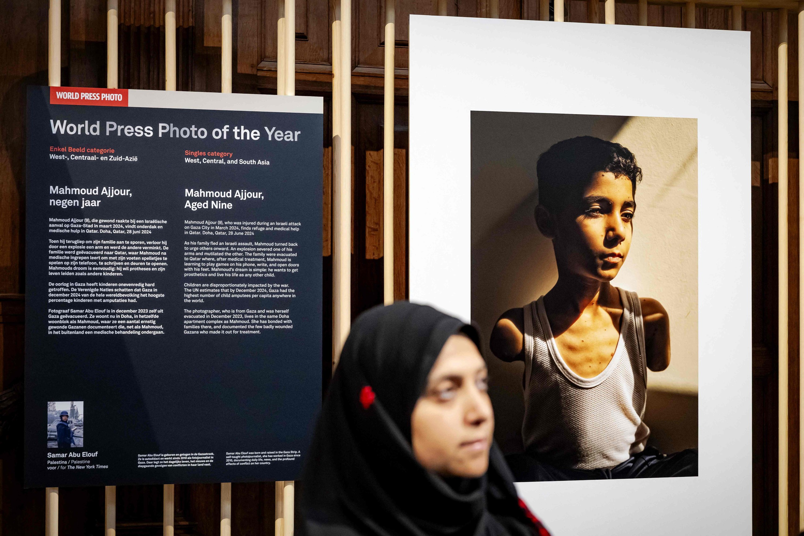 Picture of Palestinian boy who lost both arms in Gaza attack is World Press Photo of 2025