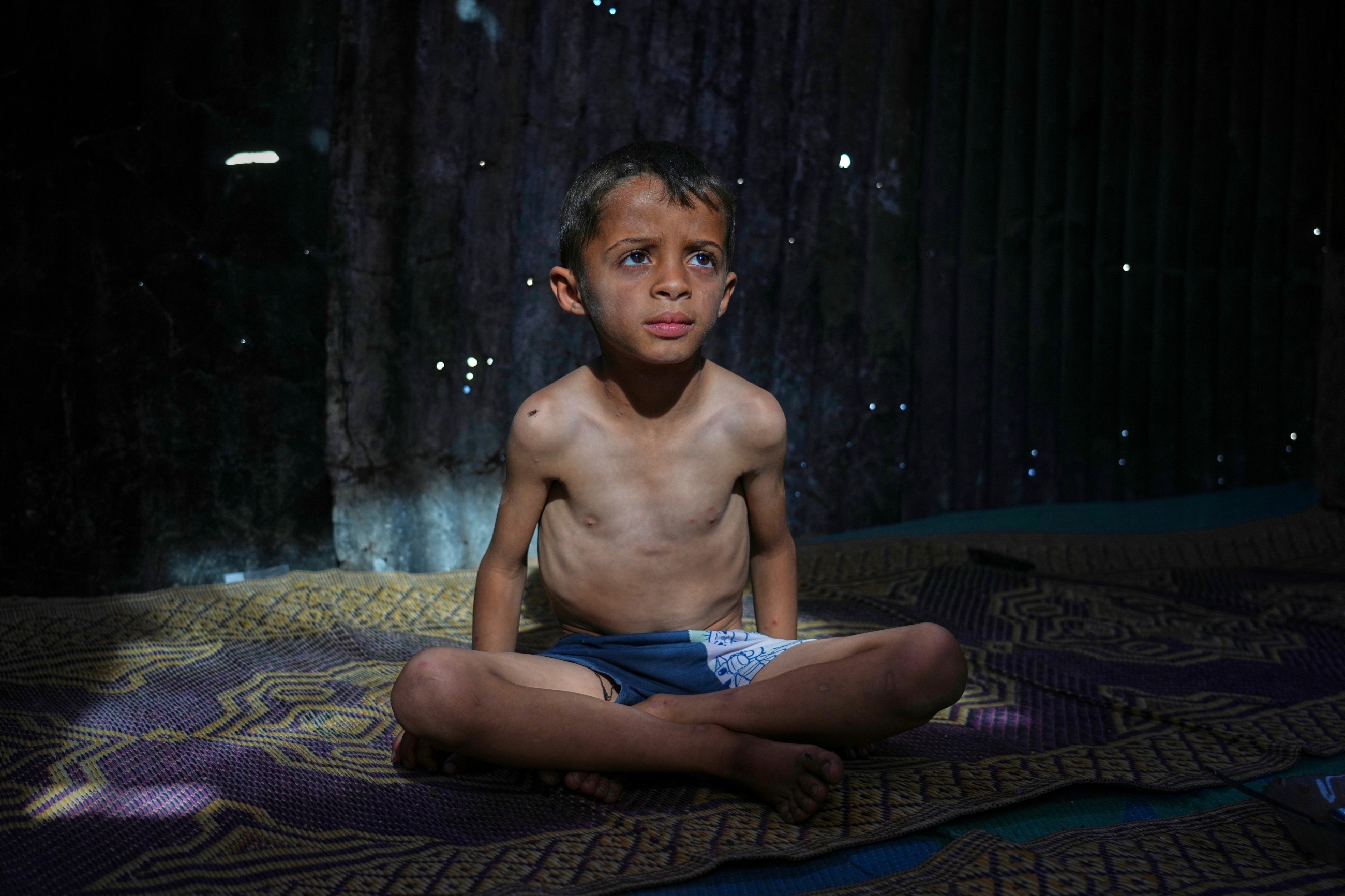 Hunger, malnutrition rise across Gaza as Israel's blockade leaves mothers with few options