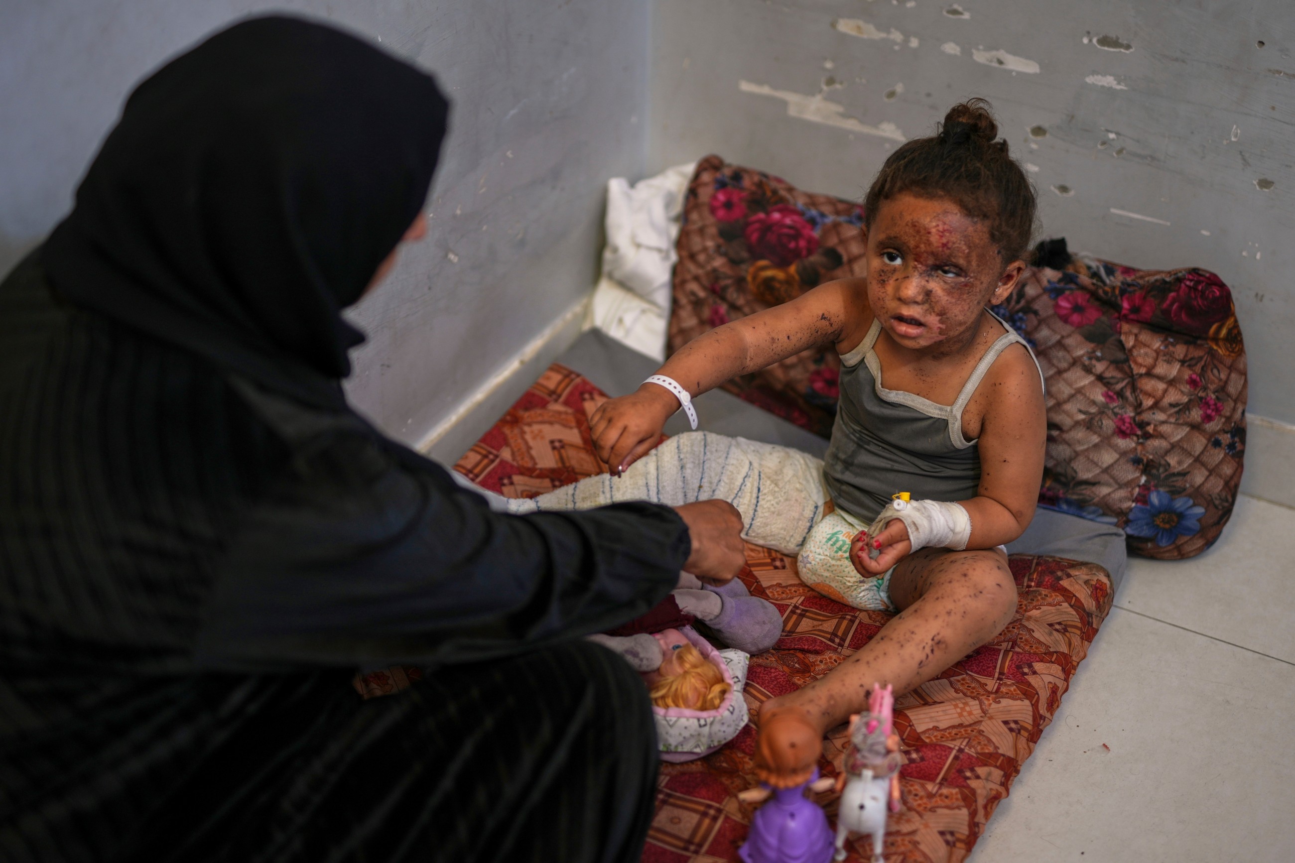 Burn patients face excruciating recovery as medicines dwindle under Israeli blockade of Gaza