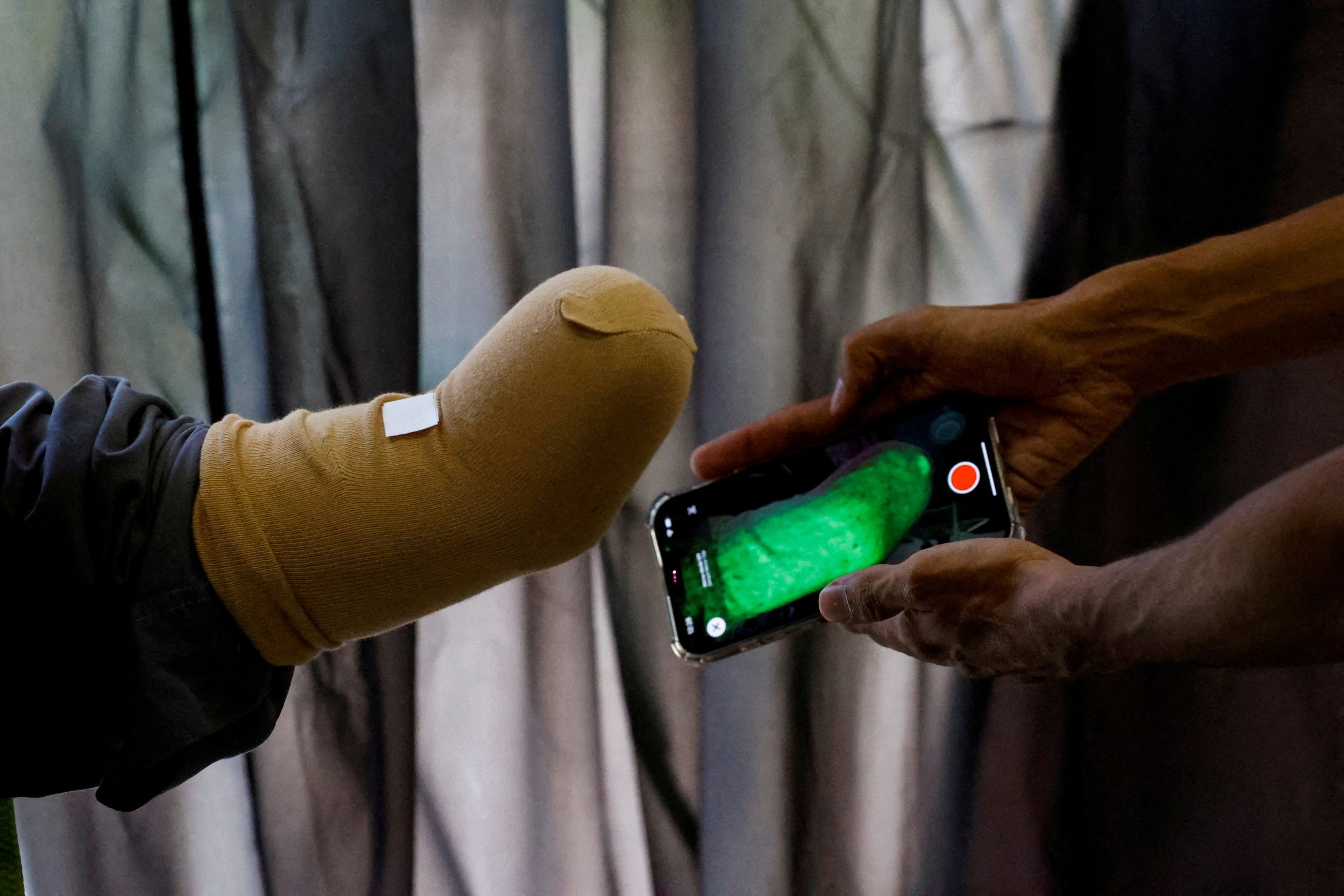 From Karachi to Gaza: Pakistani startup enlivens Palestinian child amputees with prosthetics