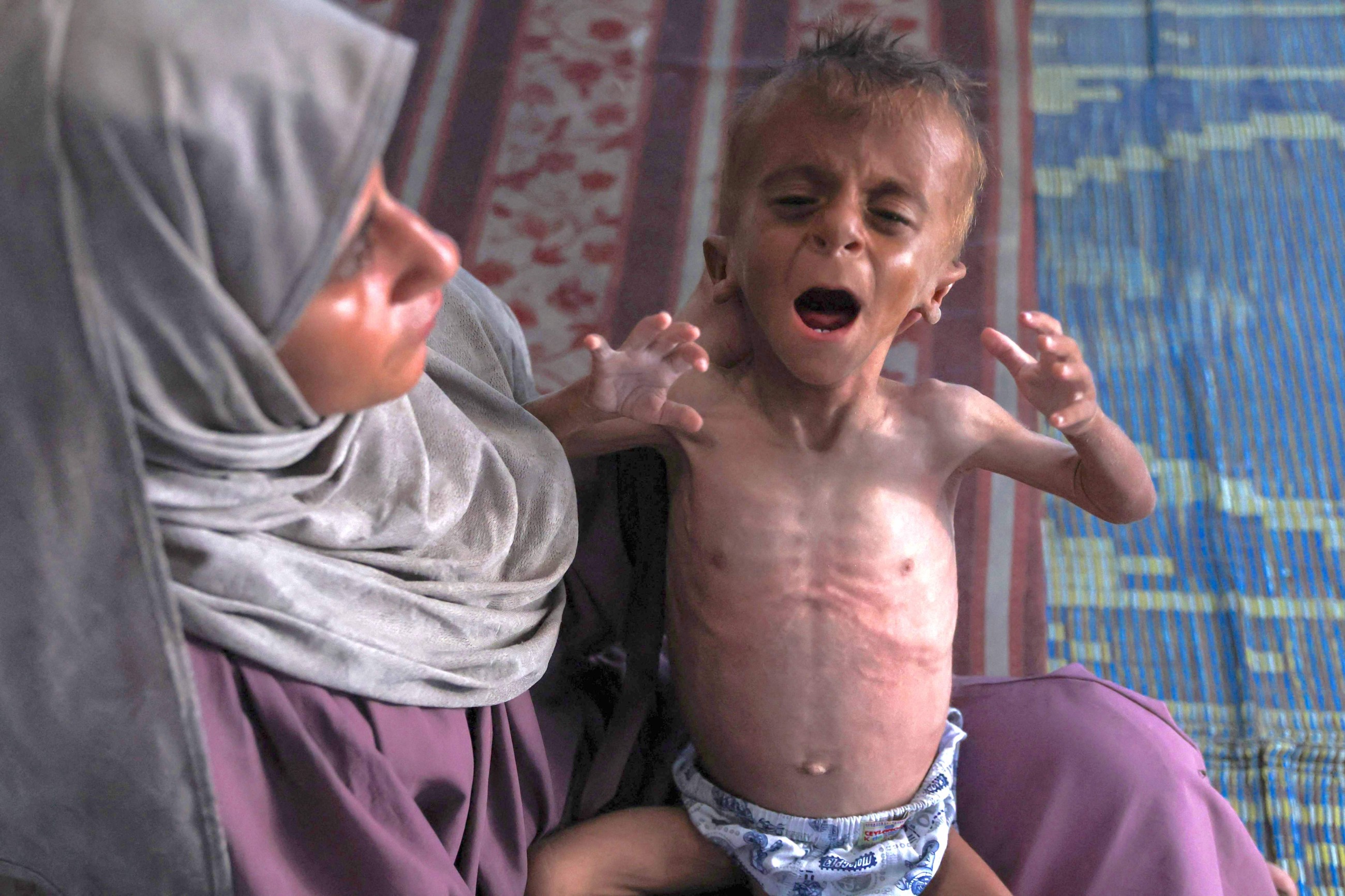 ‘People in Gaza are neither dead nor alive, they are walking corpses,’ says UN agency