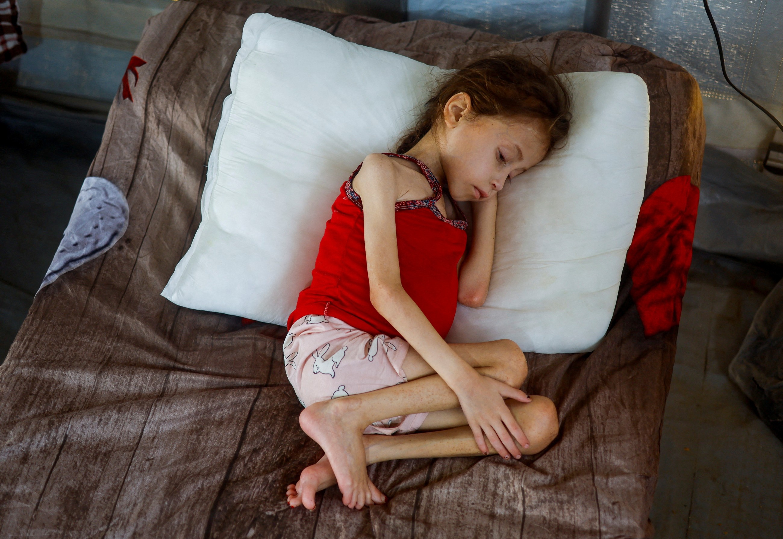 Gaza mother worries time running out for evacuation of malnourished daughter