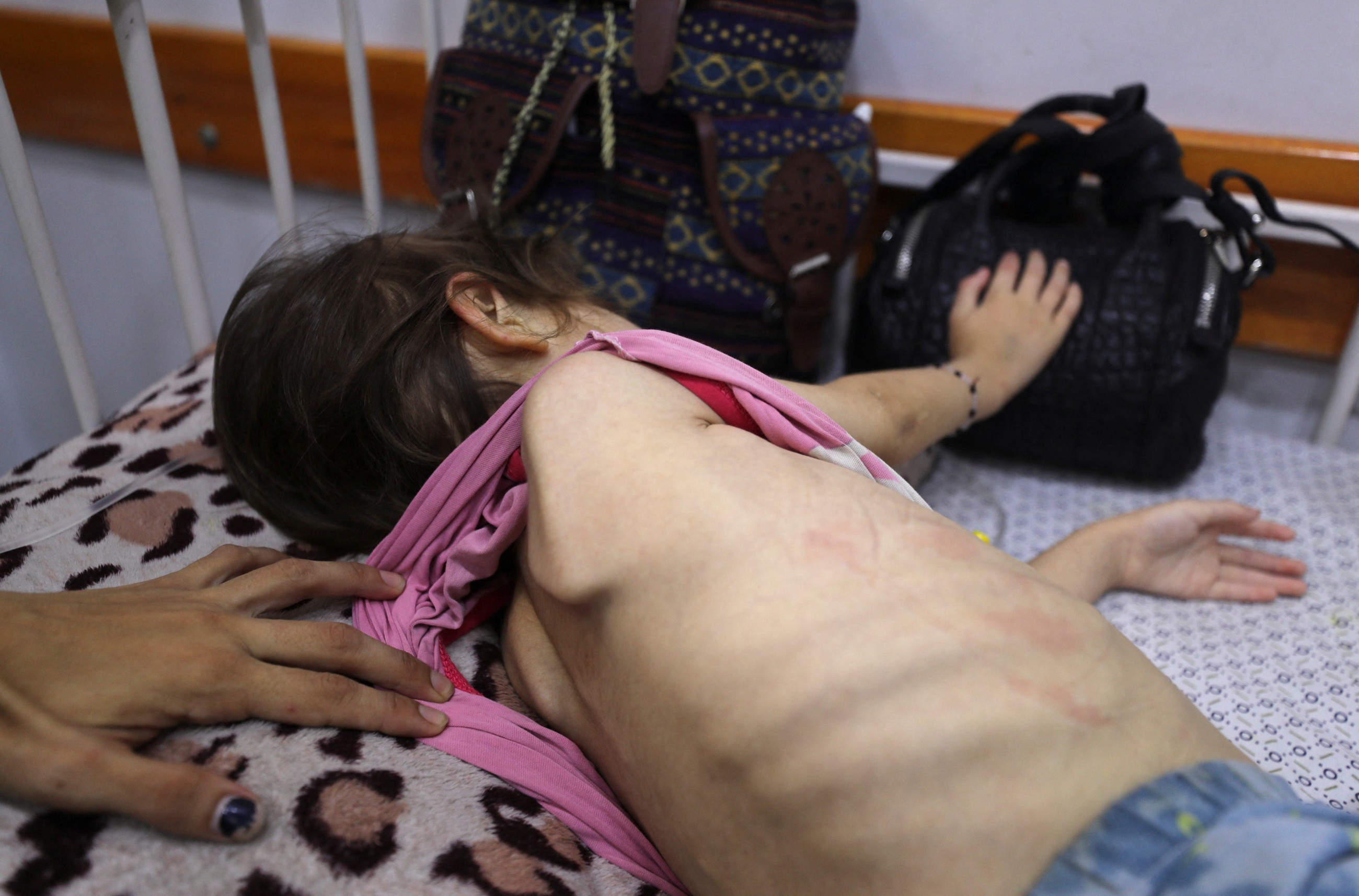 Gaza mother worries time running out for evacuation of malnourished daughter