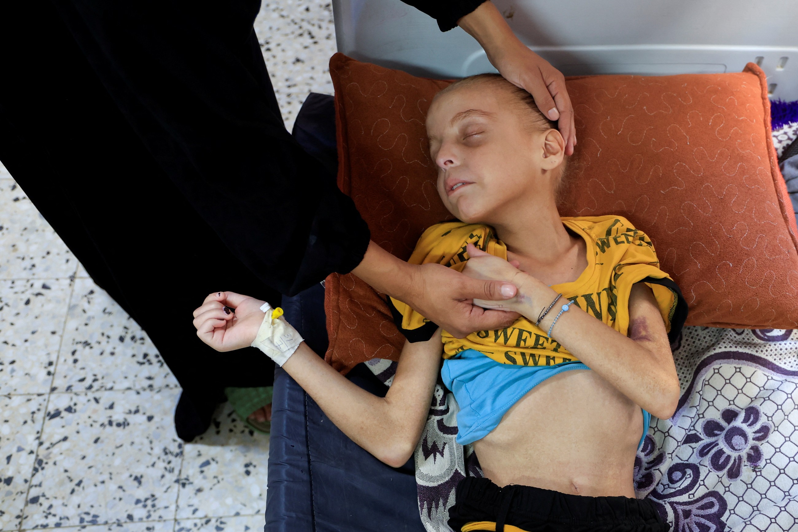 Gaza father grieving loss of child to malnutrition scrambles to save siblings