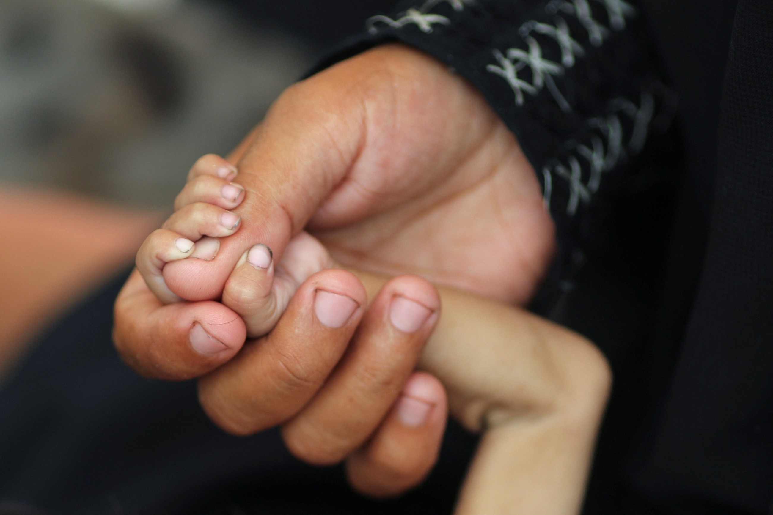 Gaza father grieving loss of child to malnutrition scrambles to save siblings
