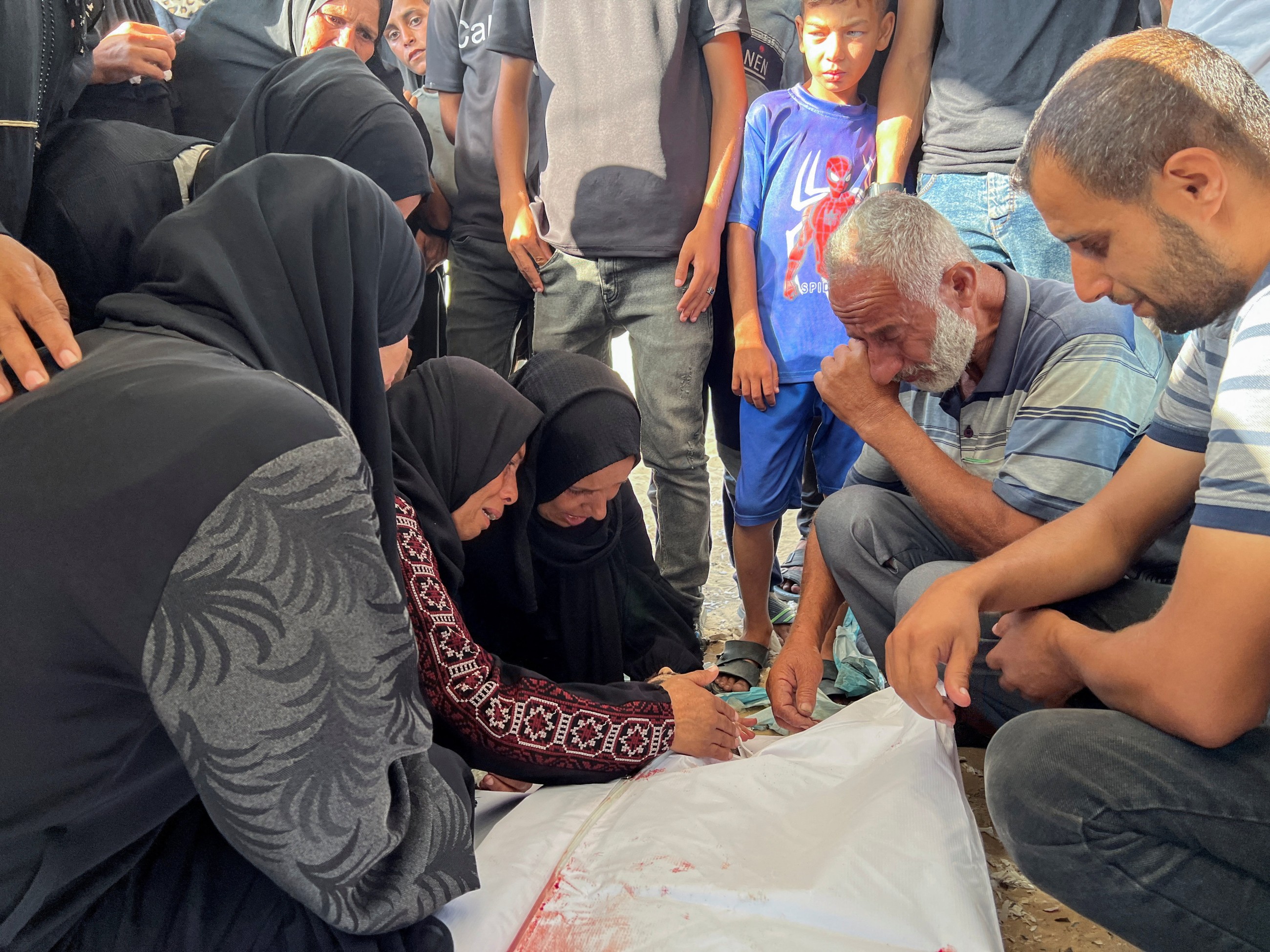 Gaza father grieving loss of child to malnutrition scrambles to save siblings