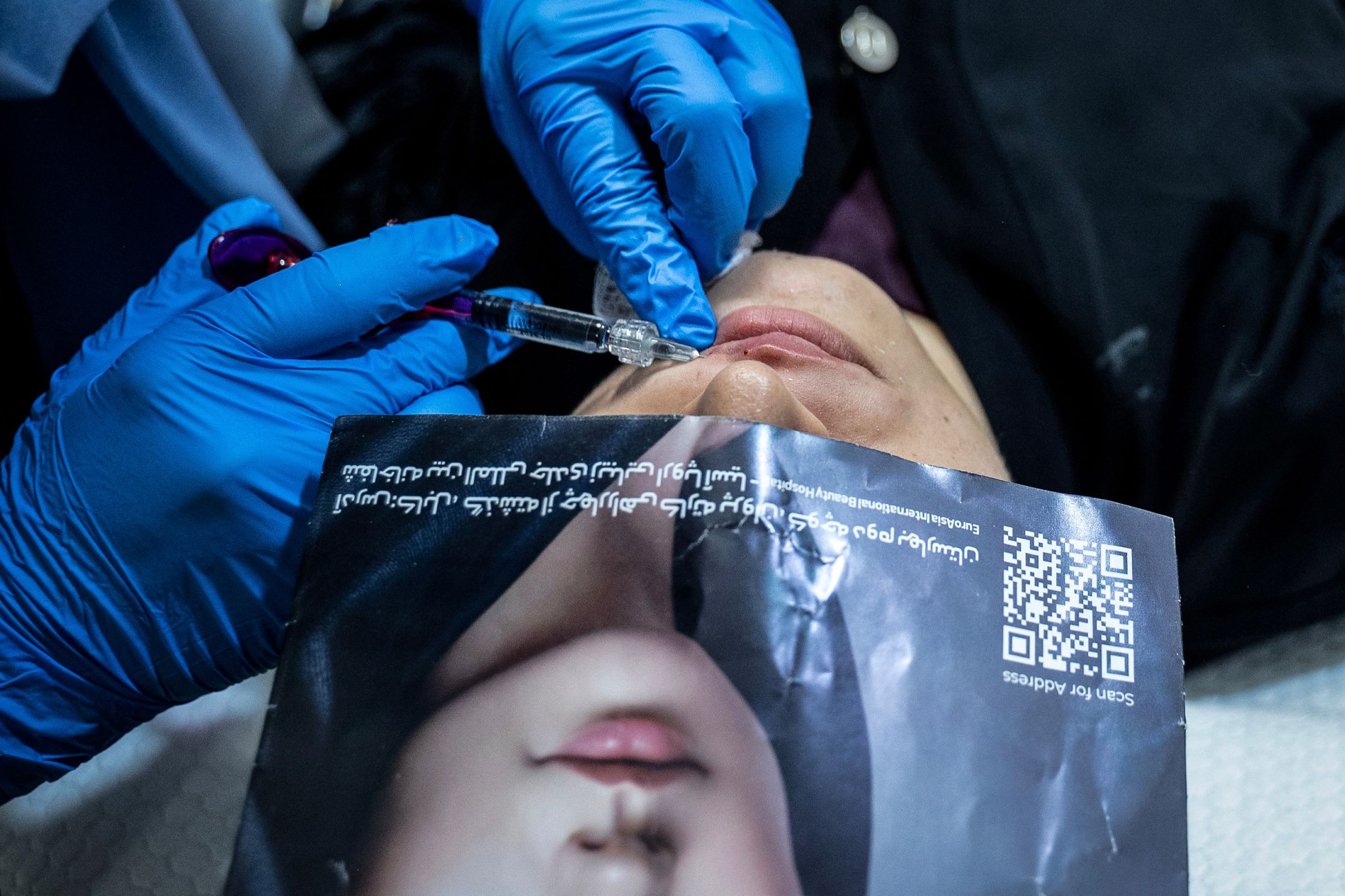 Botox under burqas: Cosmetic surgery in vogue in Afghanistan