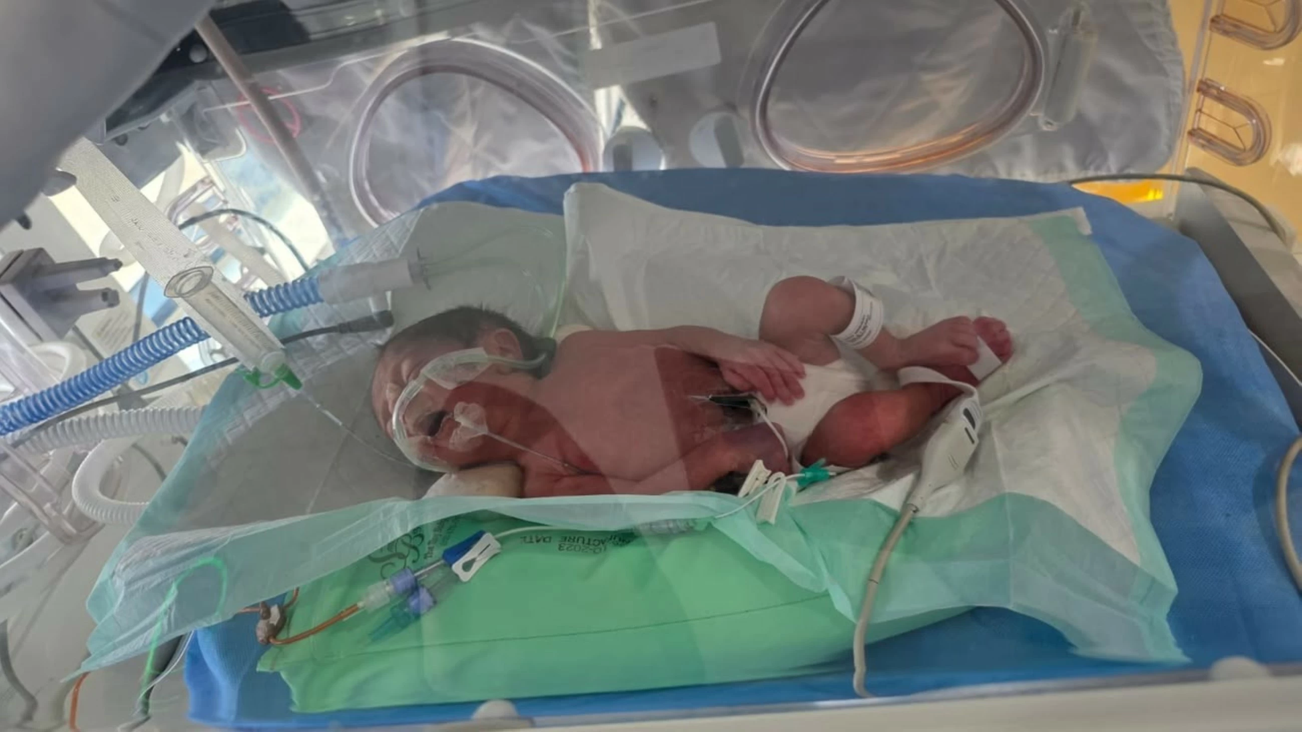 Family seeks financial help to cover treatment bills of twin boys in Ras Al Khaimah